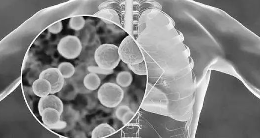 肺炎支原体引起肺部感染。据“华山感染”微信公众号

